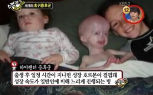 하이랜더 증후군.jpg