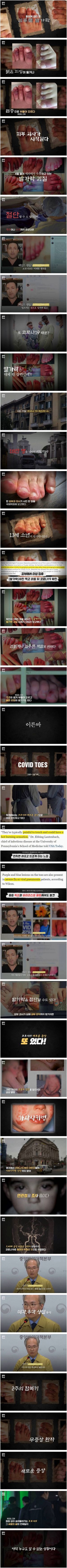 짱퀴벌레 새끼들이 낳은 괴질.jpg